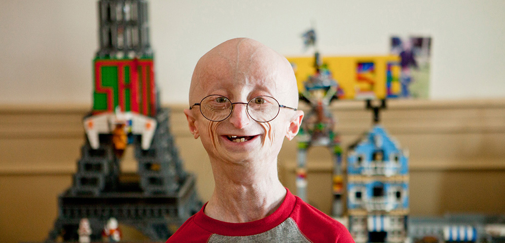 Sam Berns in Andrea Nix Fine and Sean Fine's "Life According to Sam"